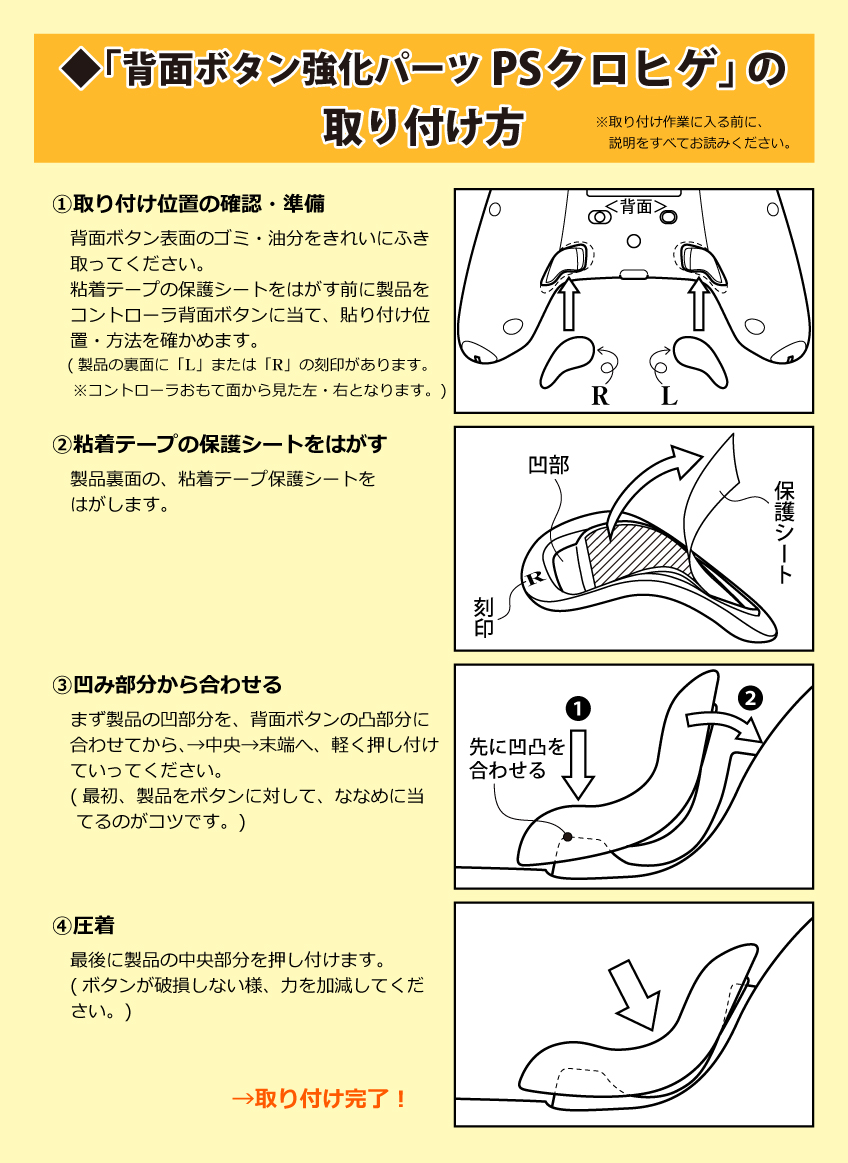 スカイダイバーテック 背面ボタン強化パーツ PSクロヒゲ玄髭は、取り付けもとても簡単!!
